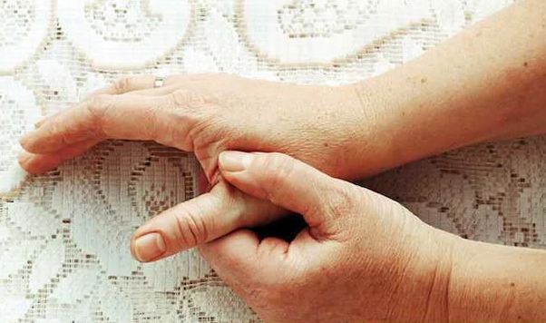 Rheumatoid Arthritis: Early Signs And Symptoms To Watch Out For